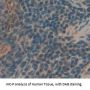 Killer Cell Immunoglobulin Like Receptor 2DS4 (KIR2DS4) Antibody