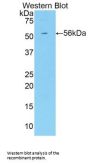 KIR3DL2 Antibody