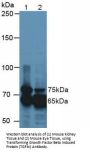Transforming Growth Factor Beta Induced Protein (TGFbI) Antibody
