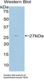 Transforming Growth Factor Beta Induced Protein (TGFbI) Antibody