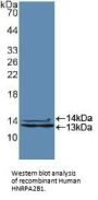 Heterogeneous Nuclear Ribonucleoprotein A2/B1 (HNRNPA2B1) Antibody
