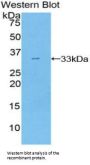 Src Homology 2 Domain Containing Adapter Protein B (SHB) Antibody