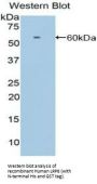 Low Density Lipoprotein Receptor Related Protein 8 (LRP8) Antibody