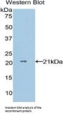 Non Metastatic Cells 1, Protein NM23A Expressed In (NME1) Antibody