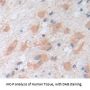 Non Metastatic Cells 1, Protein NM23A Expressed In (NME1) Antibody