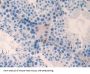 NME3 Antibody
