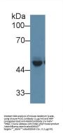 Protein Interacting With Protein Kinase C Alpha 1 (PICK1) Antibody