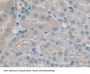 Protein Interacting With Protein Kinase C Alpha 1 (PICK1) Antibody