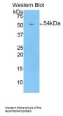 Ectonucleotide Pyrophosphatase/Phosphodiesterase 1 (ENPP1) Antibody