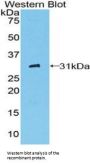 Receptor II For The Fc Region of Immunoglobulin G (FcgRII) Antibody