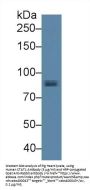 Signal Transducer And Activator of Transcription 1 (STAT1) Antibody