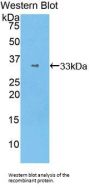 Signal Transducer And Activator of Transcription 1 (STAT1) Antibody