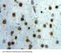 Signal Transducer And Activator of Transcription 1 (STAT1) Antibody