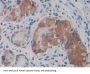 Von Willebrand Factor A Domain Containing Protein 1 (vWA1) Antibody
