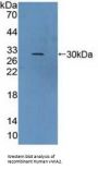 Von Willebrand Factor A Domain Containing Protein 2 (vWA2) Antibody
