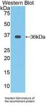 C-Raf Proto Oncogene Serine/Threonine Protein Kinase (CRAF) Antibody