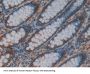 C-Raf Proto Oncogene Serine/Threonine Protein Kinase (CRAF) Antibody