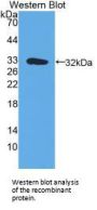 MHCDRa Antibody