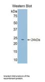 Poly A Binding Protein Cytoplasmic 1 Like Protein (PABPC1L) Antibody
