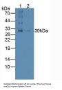 Tumor Necrosis Factor Ligand Superfamily Member 11 (TNFSF11) Antibody
