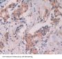Signal Transducer And Activator of Transcription 5A (STAT5A) Antibody