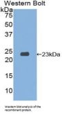 Signaling Threshold Regulating Transmembrane Adaptor 1 (SIT1) Antibody