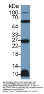 Tumor Necrosis Factor Ligand Superfamily, Member 12 (TNFSF12) Antibody