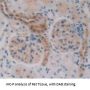 Tumor Necrosis Factor Receptor Superfamily Member 1A / CD120a (TNFRSF1A) Antibody