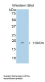 TNFRSF21 Antibody