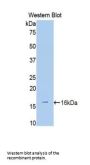 ADAMTS1 Antibody
