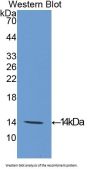 Eukaryotic Translation Initiation Factor 4E Binding Protein 1 (EIF4EBP1) Antibody