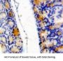 Eukaryotic Translation Initiation Factor 4E Binding Protein 1 (EIF4EBP1) Antibody