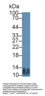 Regulated On Activation In Normal T-Cell Expressed And Secreted (RANTES) Antibody