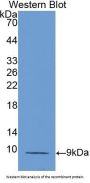 RANTES Antibody