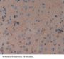 Tumor Necrosis Factor Receptor Superfamily, Member 19 Like Protein (TNFRSF19L) Antibody