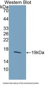 Histone Cluster 2, H3a (HIST2H3A) Antibody