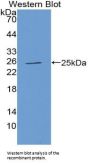 Metalloproteinase Inhibitor 3 (TIMP3) Antibody