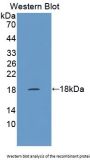 Collagen Type X Alpha 1 (COL10A1) Antibody