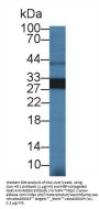 Heme Oxygenase 1, Decycling (HO1) Antibody