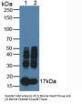 Myoglobin (MB) Antibody