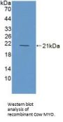 Myoglobin (MB) Antibody