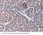 Myoglobin (MB) Antibody