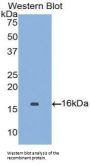 Angiopoietin 2 (ANGPT2) Antibody
