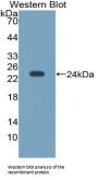 Nitric Oxide Synthase, Endothelial (NOS3) Antibody