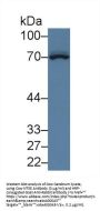 5'-Nucleotidase / CD73 (NT5E) Antibody