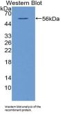 5'-Nucleotidase / CD73 (NT5E) Antibody