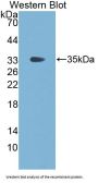 Fibrinogen Gamma (FGG) Antibody
