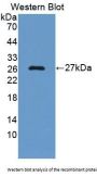 Alpha-1-B Glycoprotein (A1BG) Antibody