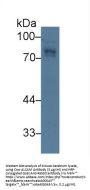 Activated Leukocyte Cell Adhesion Molecule / CD166 (ALCAM) Antibody