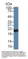 Apolipoprotein M (APOM) Antibody